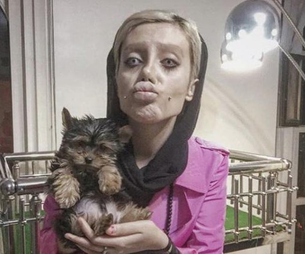 Когда девушке удалось сбросить "лишние" килограммы, она приступила к пластическим операциям (в общей сложности речь идет о 50 медицинских процедурах!).