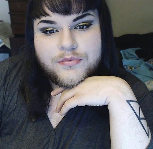 3. Избавиться от избыточного роста волос при гирсутизме полностью не возможно