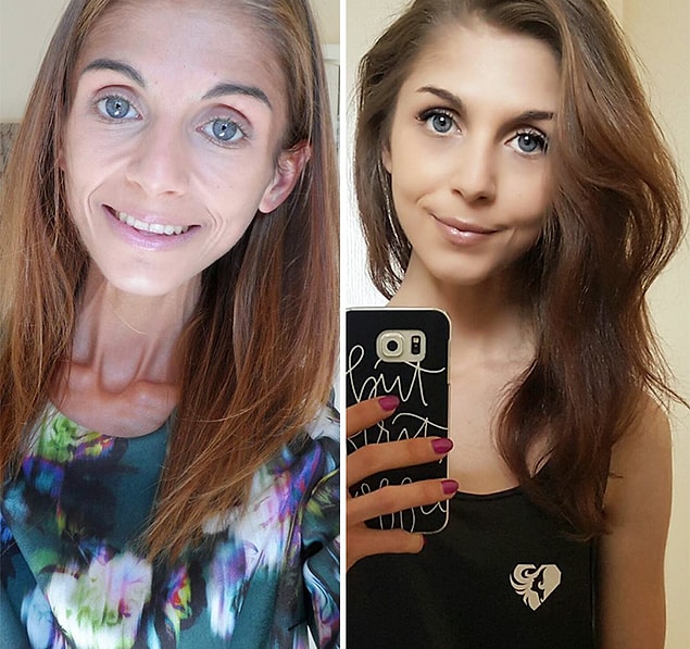 25.