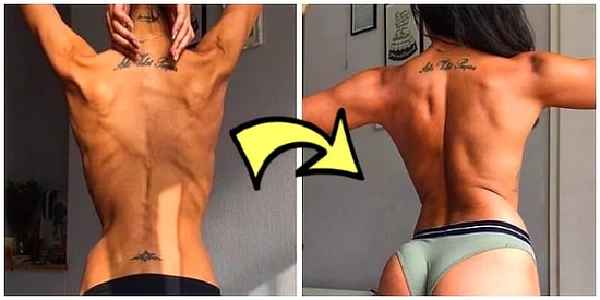 Azmin Zaferi! Anoreksiya Hastalığını Yenip Kilo Alanların Yaşadığı Efsanevi Değişimler! 💪