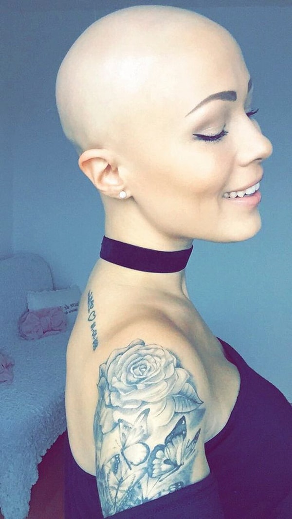 Благодаря поддержке своих друзей и семьи Тереза, наконец, решила принять свою болезнь.