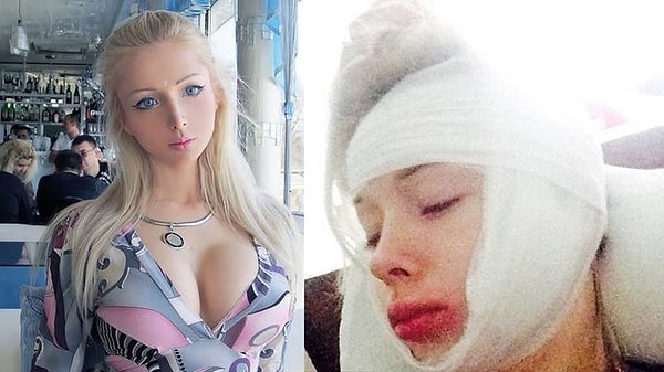 3. Однажды Барби жестоко избили