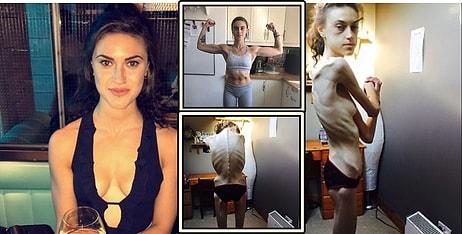 Anoreksiya Yüzünden 32 Kiloya Düşen Kadın, İlham Verici Instagram Hesaplarından Etkilenerek Hayata Döndü!