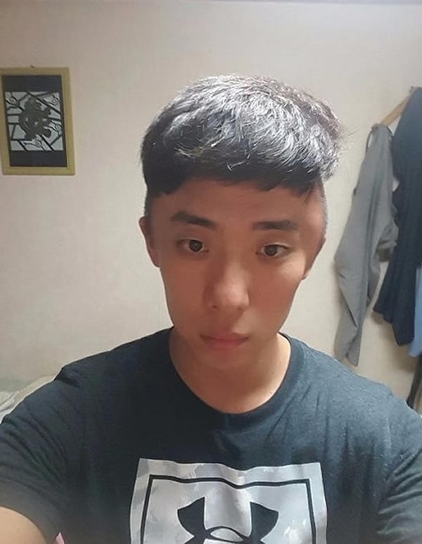 3. С одной стороны шишка заметно увеличилась.