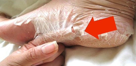 12 весомых причин, по которым у вас теперь появится новый страх — подофобия