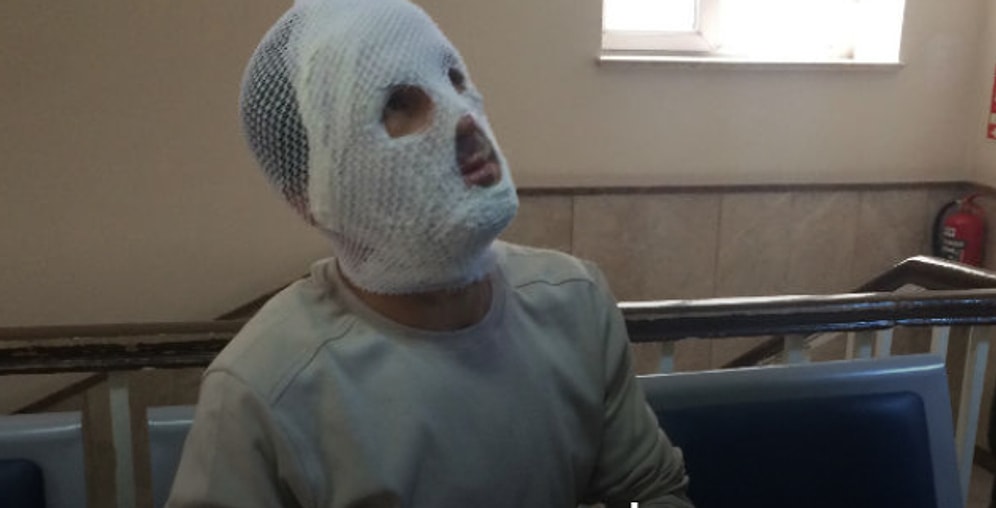 Beş Yıldır İş Bulamayan İşçi TBMM Önünde Kendini Yaktı: 'Bunalıma Girdim, Sesimi Duyurmak İçin Yaptım'