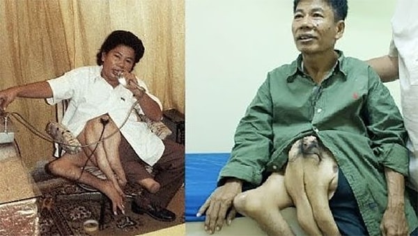 7. Руди Сантос