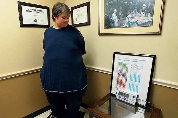 Конечно же, сама диета для пациента выглядит не таким образом.