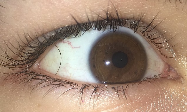 2. 😖