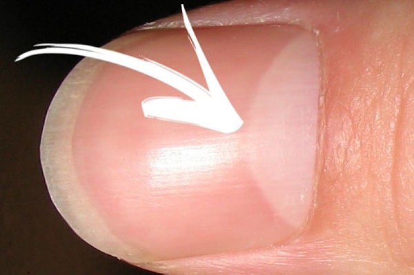 6. Как называется белая полоска в основании ногтя, которая своей формой напоминает полумесяц? 🌙