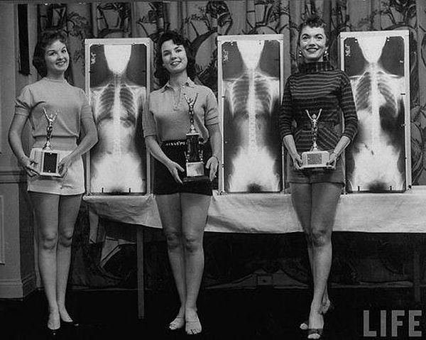 17. Мисс идеальная осанка на съезде мануальщиков в 1956 г.