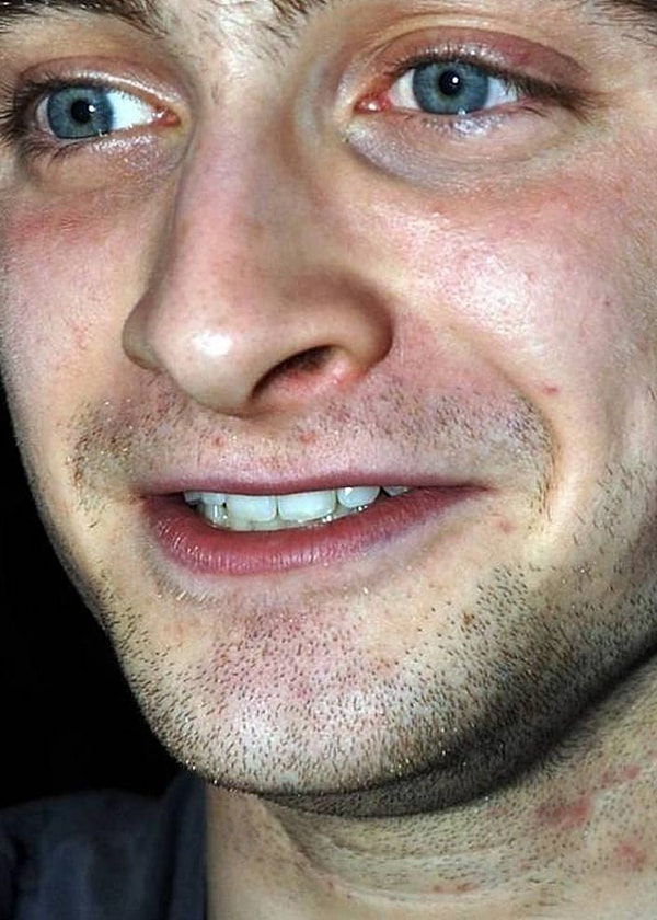 5. Дэниел Рэдклифф