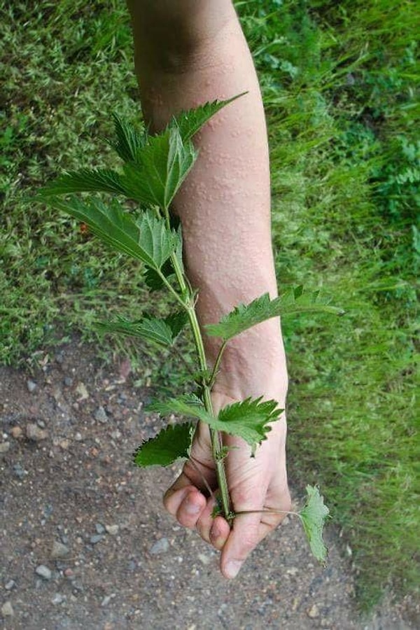 5. Почувствуй всю боль и жжение