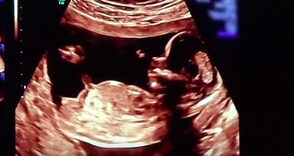 5. Вот так выглядел ребенок на 15-й неделе 😍