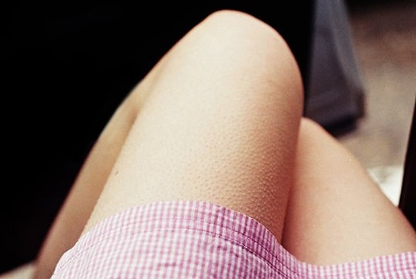 9. Часто ли у вас на коже бывают мурашки?