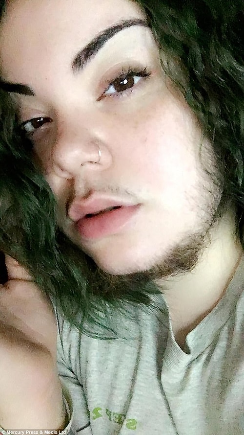 У 24-летней Алмы Торрес были такие же проблемы, как у Анналисы. Ситуация с Алмой была еще более сложной.