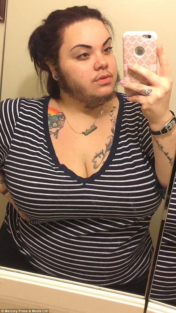 6. Сейчас Алма пытается помочь всем женщинам, живущим с этим страшным диагнозом.