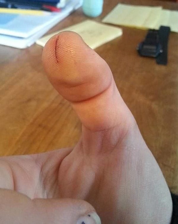 4. Вот такой вот порез... 🙄