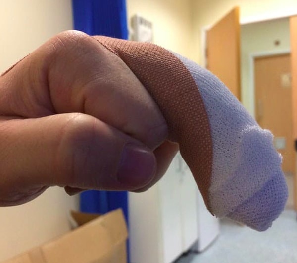 3. Нет-нет, это просто палец после операции...