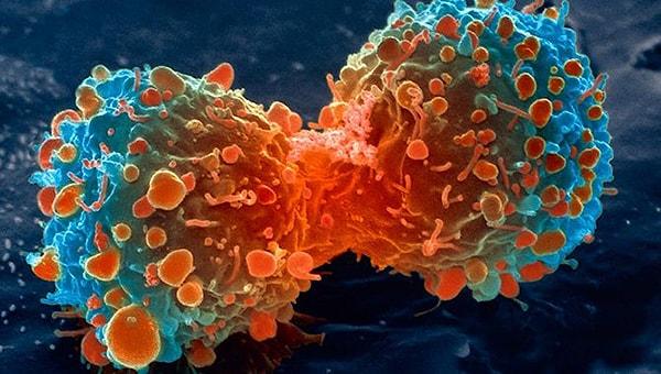Risk yok mu? Var. Yeni hücrelerin kontrolsüz bölünmelerinin önüne geçilemediği takdirde, kök hücre yöntemi kansere sebep olabilir.