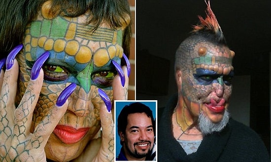 AIDS Olduğunu Öğrendikten Sonra 400 Bin Dolar Harcayıp Ejderhaya Dönüştü!