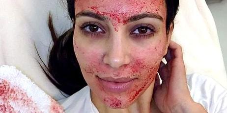 Kim Kardashian'ın Acısına Bir Daha Katlanıp Yaptırmayacağı Güzellik Uygulaması: Kan Maskesi