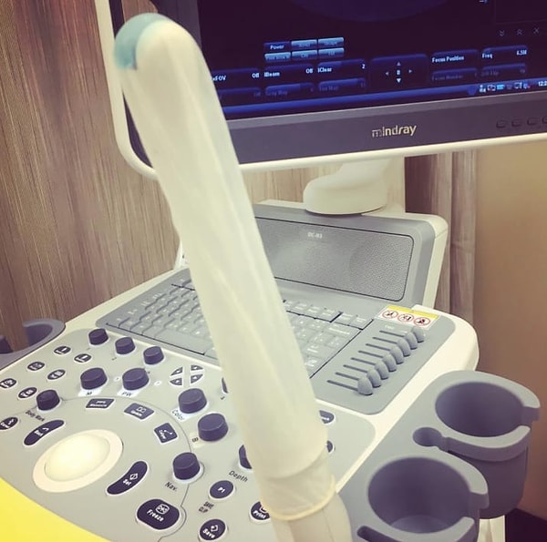 17. Если у вас проблемы с зачатием первого ребенка, это не значит, что со вторым будет так же (и наоборот)