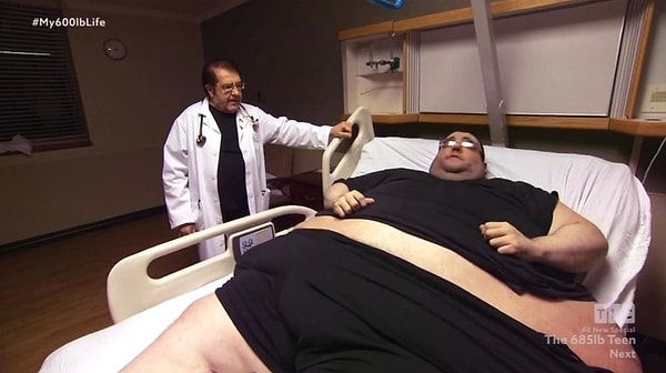 6. Когда Бучел сбросил еще 36 кг, врачи решили сделать ему операцию, чтобы убрать лишнюю кожу. И вот тут-то все и пошло не так…