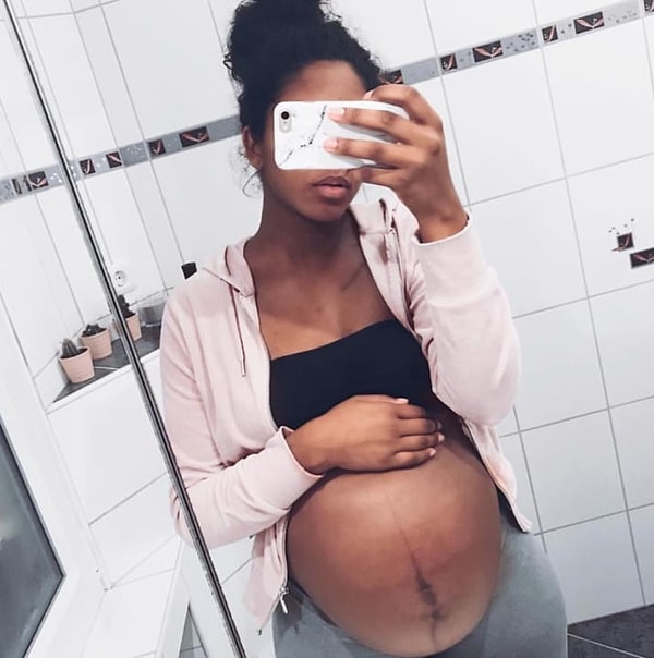 11. Видя, как растягивается кожа на животе, вы просто недоумеваете, думая, что это происходит не с вами 🙄