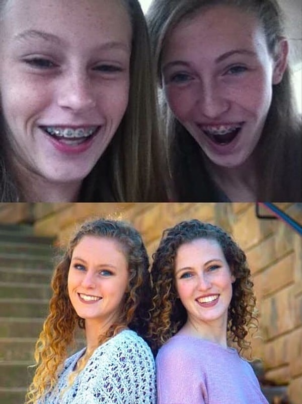 7. А зубы-то, зубы! 😎