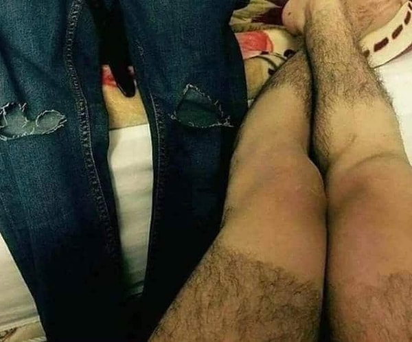 15. А это что жертва неудачной депиляции?