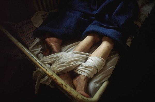 28. Romanya'da ayağından yatağına bağlanmış hasta. Tarih belirsiz.