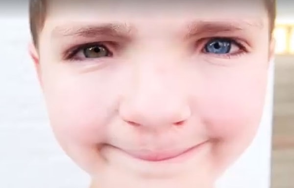 1. Знакомьтесь, это Мэдден. Ему 7 лет, и он очень необычный парень. У мальчика есть сразу две чрезвычайно редкие особенности — заячья губа и полная гетерохромия, которая бывает только у 1% населения.