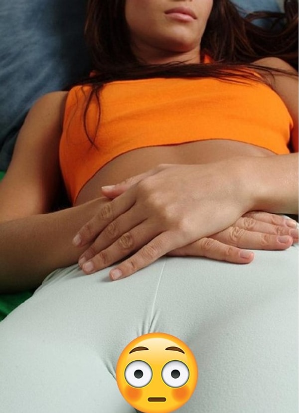 7. Верблюжья лапка