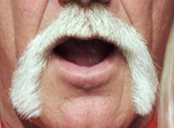 11. Кому принадлежат эти усы?