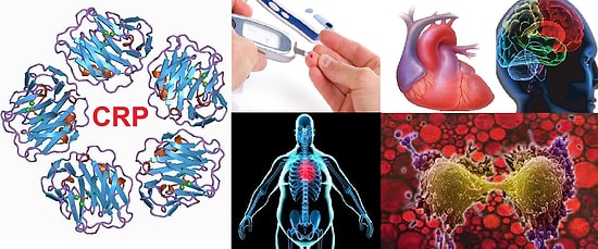 Hastalık Habercisi CRP Nedir? CRP ve Yüksekliği Hakkında Bilmeniz Gereken 5 Detay