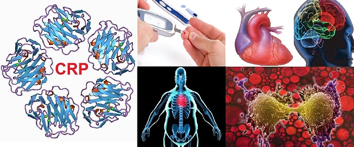 Hastalık Habercisi CRP Nedir? CRP ve Yüksekliği Hakkında Bilmeniz Gereken 5 Detay