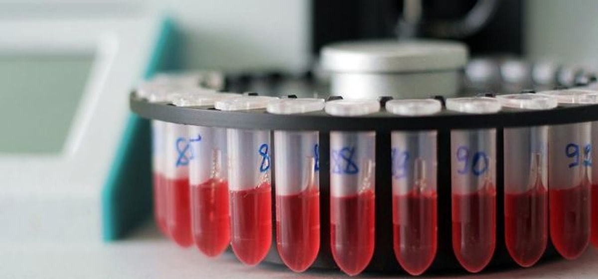 Hastalık Tespitinde Önemli Olan HCT(Hematokrit) Nedir? HCT Hakkında ...