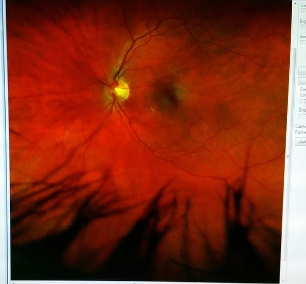 4. Человеческий глаз изнутри. Похоже на какое-то адское небо!