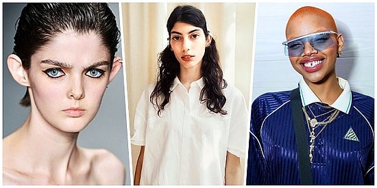 Лопоухие, конопатые и кривозубые: 11 необычных моделей, которым внешность не помешала стать знаменитыми