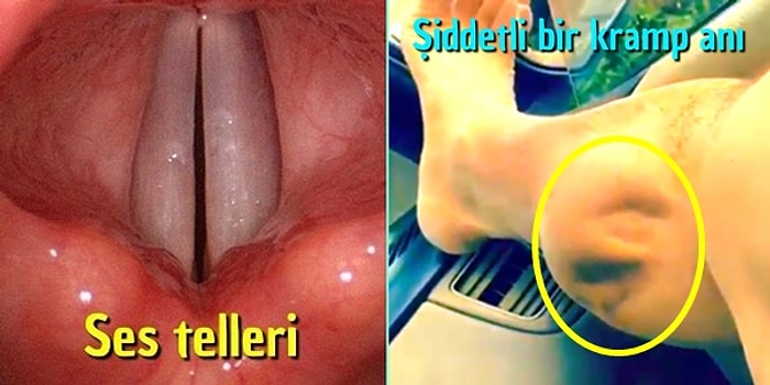 Şaşırmamak Ne Mümkün! Vücudumuzla İlgili Belki İlk Kez Göreceğiniz 17 Ekstrem Görüntü