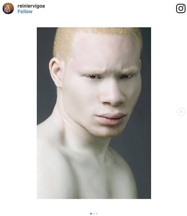 голый парень альбинос