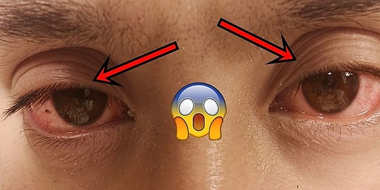 'Polifazik Uyku' Deneyi İçin Günde 5 Saat Uyuyan Adamın Yaşadığı Zorluklar