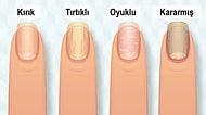 Tırnaklarınızın Sağlığınız ile İlgili Veriyor Olabileceği Bu Sinyalleri Biliyor musunuz?