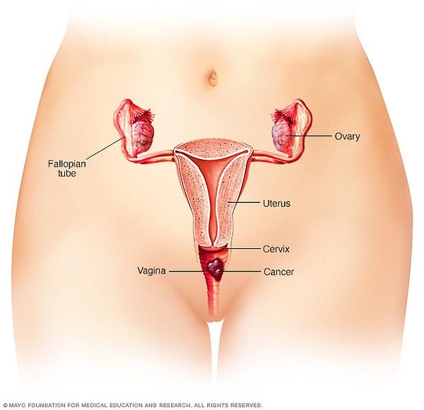 2. Klitoris'in nerede olduğunu bildiğinizi düşünüyorsanız yanılıyor olabilirsiniz. Vulva her şeyi kapsayan bir bölgedir ve labia, klitoris de içinde bulunur.