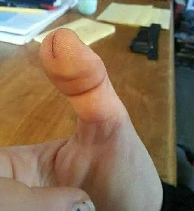 2. Bu kesik parmak da kesinlikle ama kesinlikle penise filan benzemiyor.