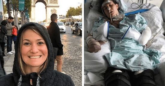 Женщина вышла из комы после родов и узнала, что теперь она слепа, без ног и без руки