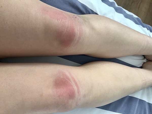 15. Интересно, чувствовали ли эти люди, как медленно сгорает кожа на их коленках?!