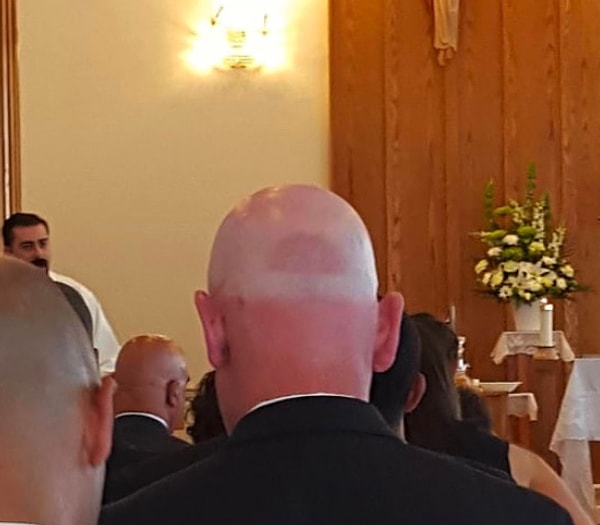 18. Хотя все это чепуха по сравнению с тем, как эффектно сгорел на солнце вот этот парень! Браво, мужик!