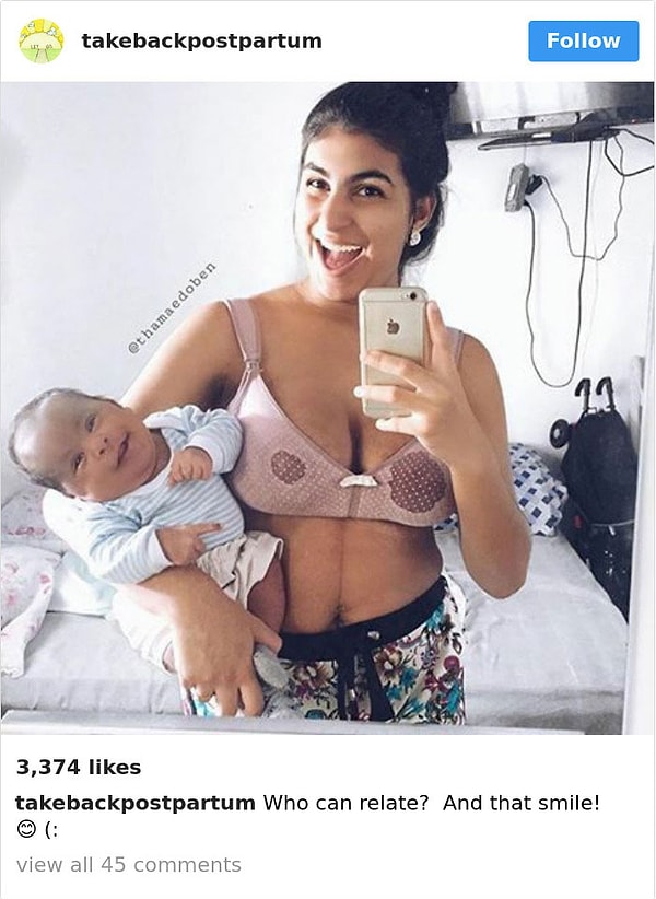 17. Это, пожалуй, самое крутое послеродовое фото, которое я видела 😍